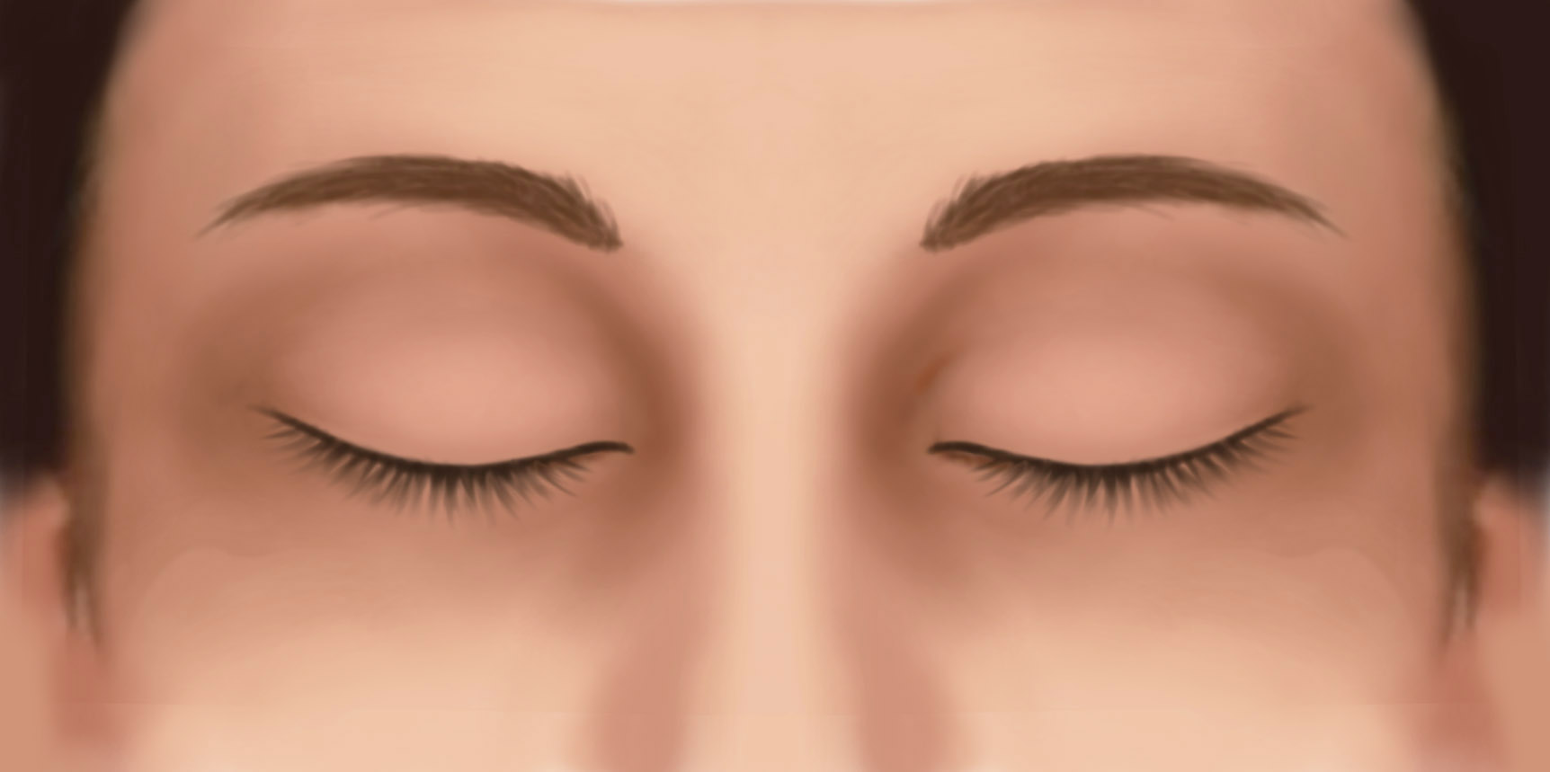 eyelid-surgery-dr-jonathan-wheeler