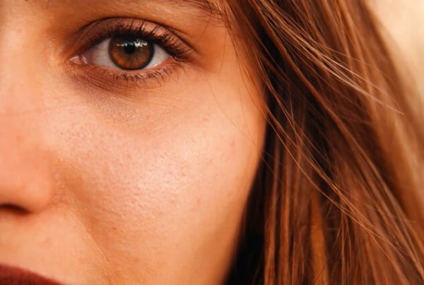 A close up of a young woman’s eye and face.