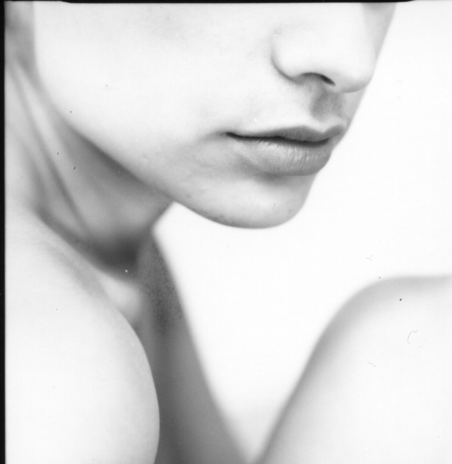 Picture of chin and nose